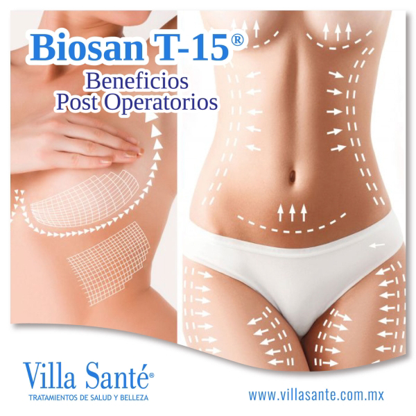 Franquicia Villa Santé Franquicia Villa Santé